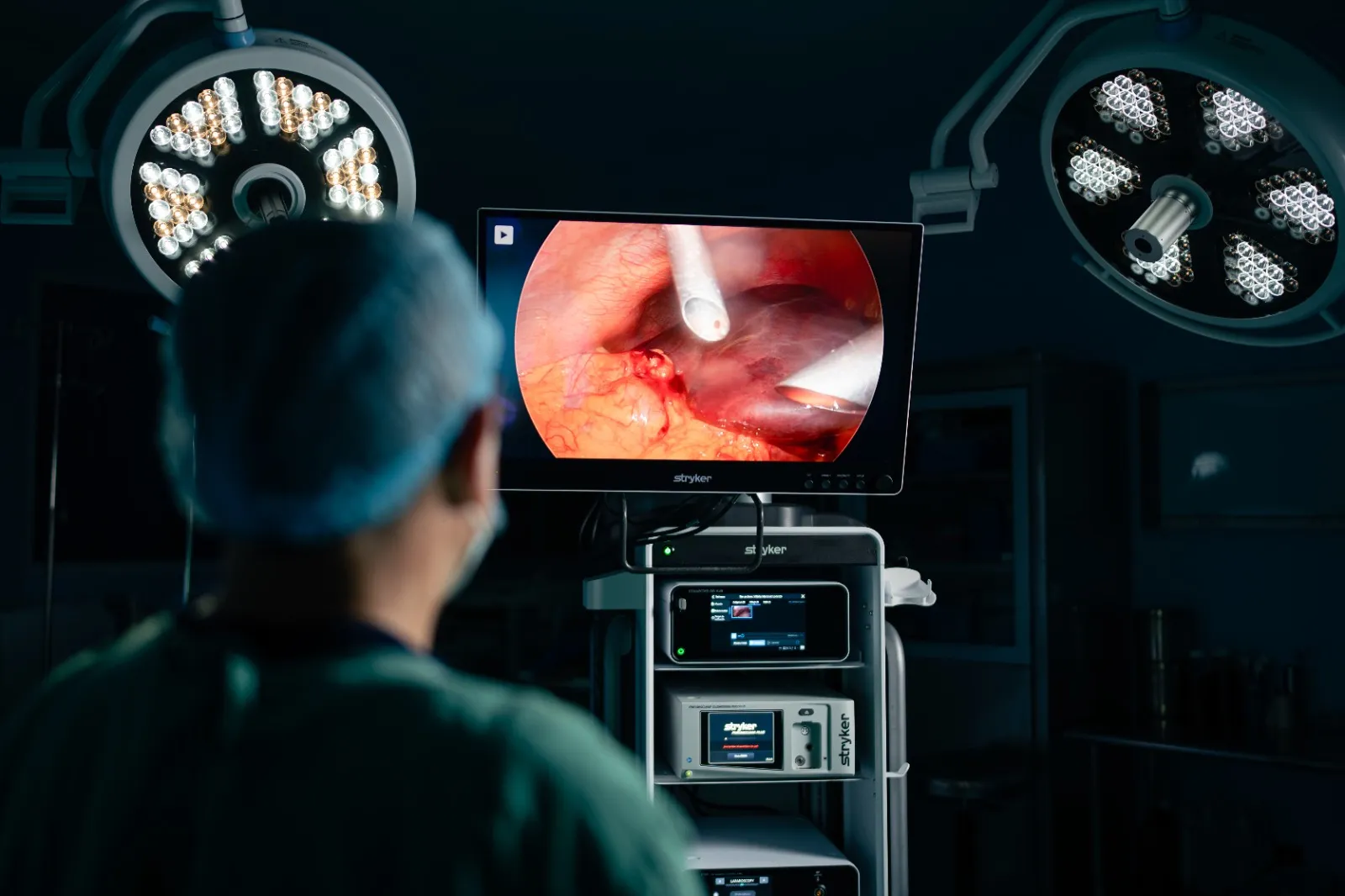 El Dr. Cardoza observa el monitor de laparoscopia durante un procedimiento